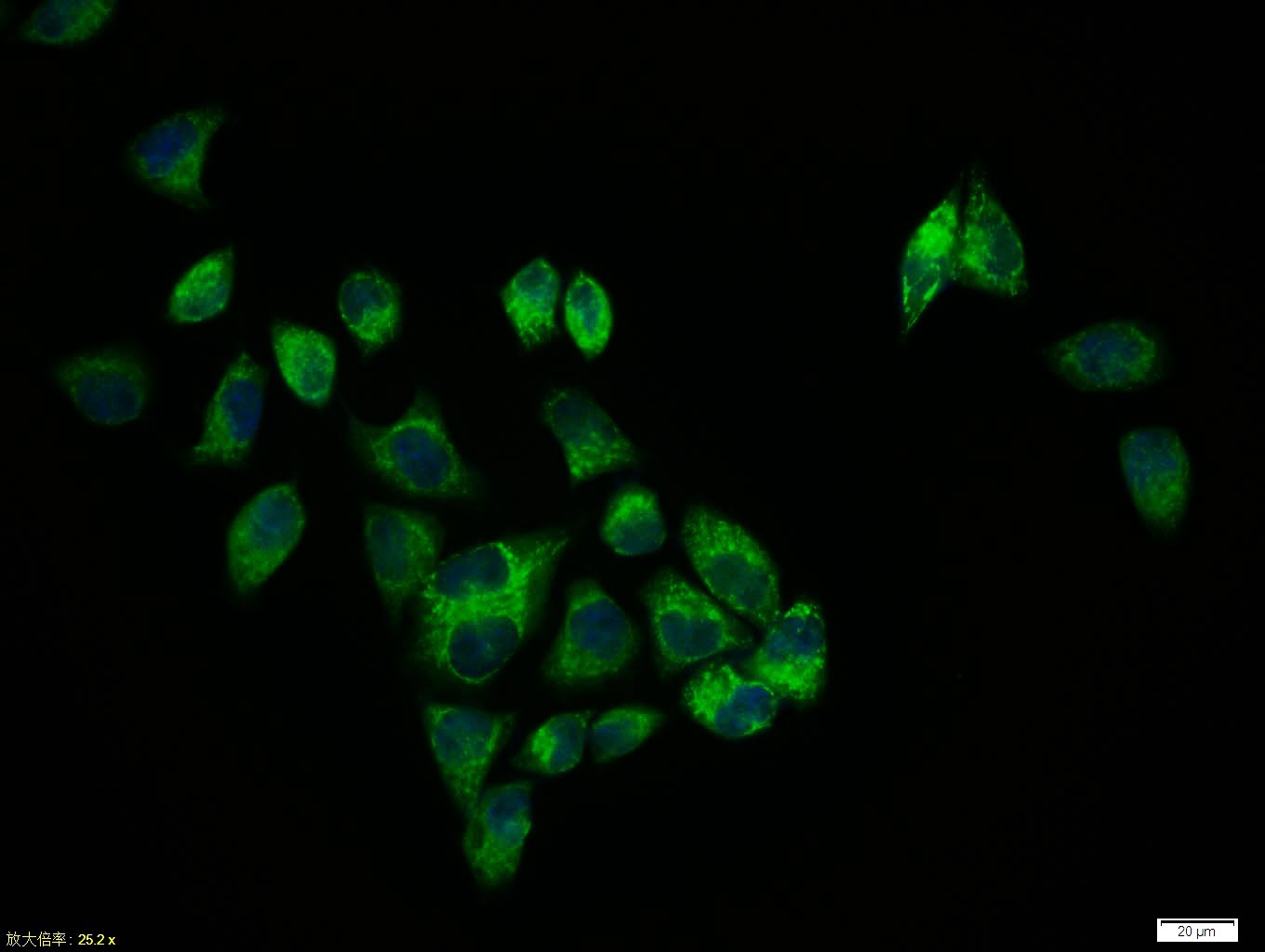 Anti-Phospho-PERK (Thr980) Polyclonal Antibody
