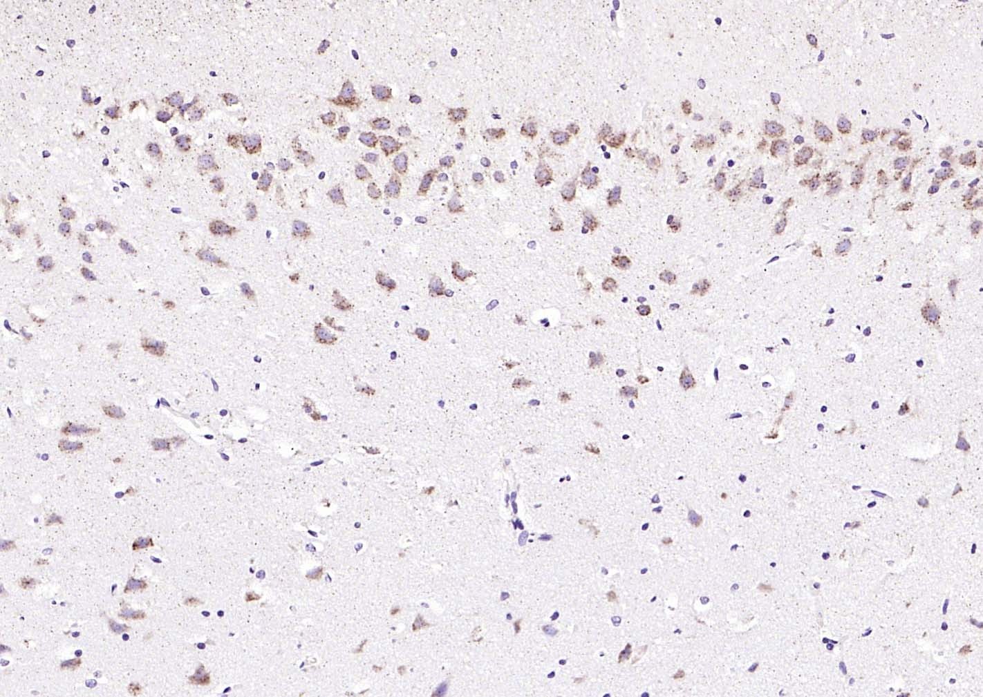 Anti-Phospho-PERK (Thr980) Polyclonal Antibody