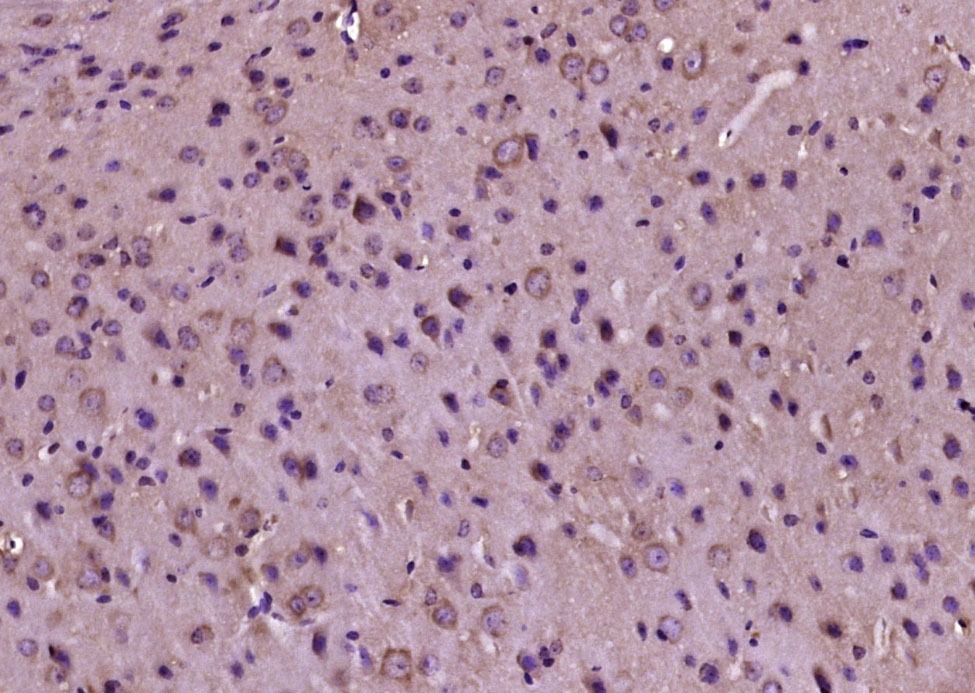 Anti-Phospho-PERK (Thr980) Polyclonal Antibody