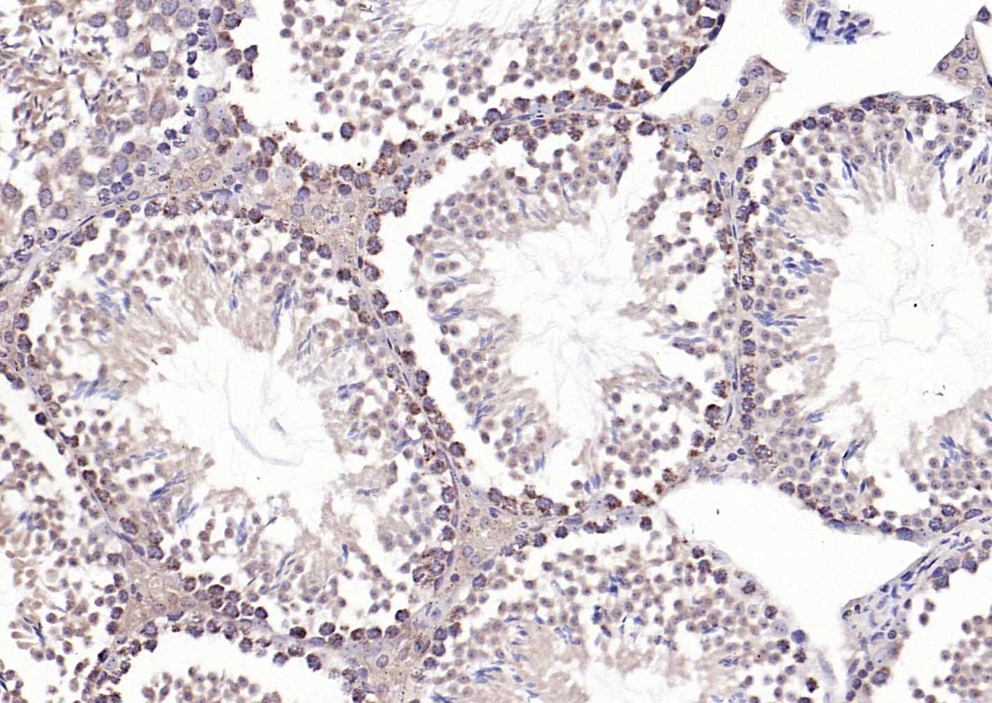 Anti-Phospho-PERK (Thr980) Polyclonal Antibody
