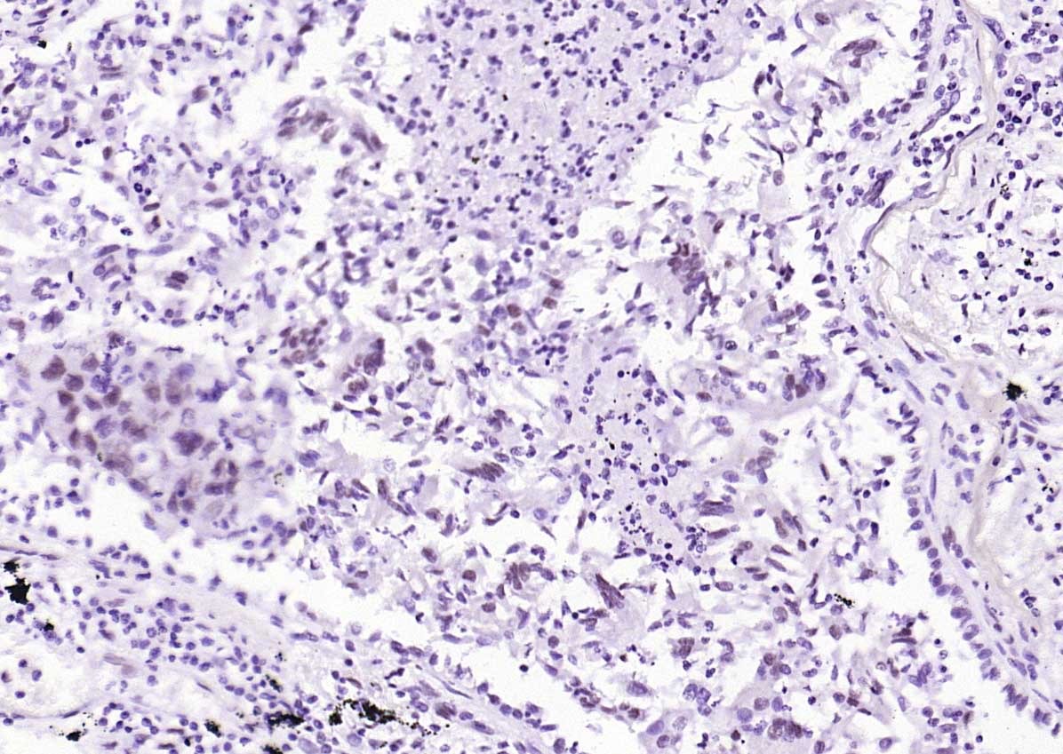 Anti-Phospho-STAT1 (Ser727) Antibody (4T516)