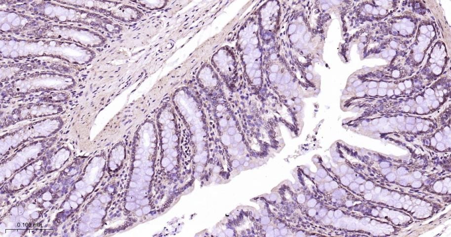 Anti-Phospho-p38 MAPK (Thr180, Tyr182) Polyclonal Antibody