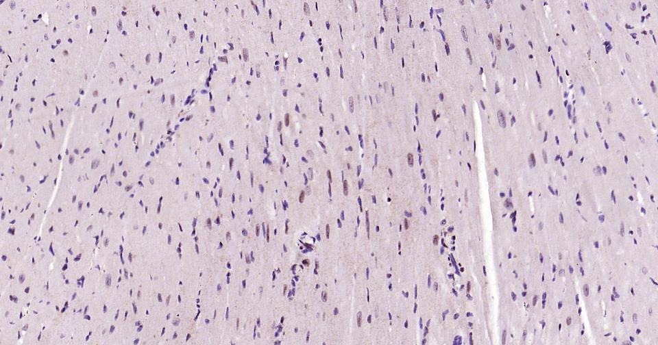 Anti-Phospho-STAT3 (Ser727) Antibody (8J881)