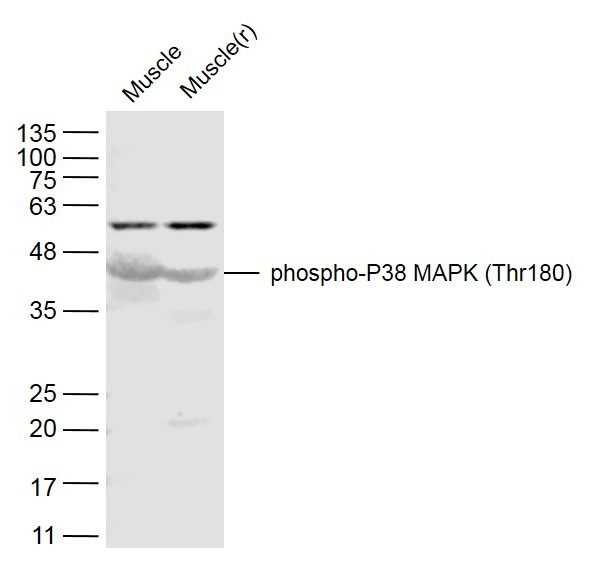 Anti-Phospho-P38 MAPK (Thr180) Polyclonal Antibody