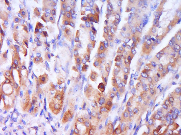 Anti-Phospho-P38 MAPK (Thr180) Polyclonal Antibody