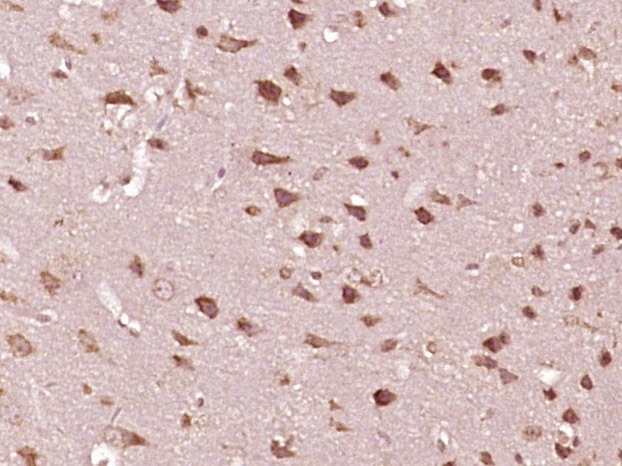 Anti-Phospho-STAT2 (Tyr690) Polyclonal Antibody