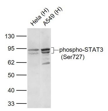 Anti-Phospho-STAT3 (Ser727) Antibody (8J881)