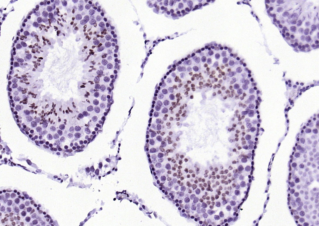 Anti-Phospho-STAT1 (Ser727) Antibody (4T516)