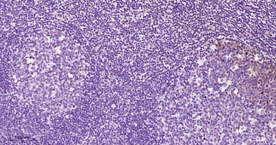 Anti-Phospho-STAT3 (Tyr705) Antibody (2J657)