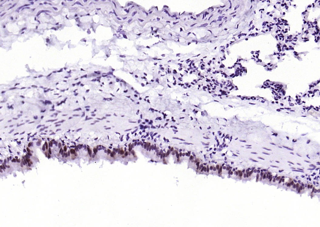 Anti-Phospho-STAT1 (Ser727) Antibody (4T516)