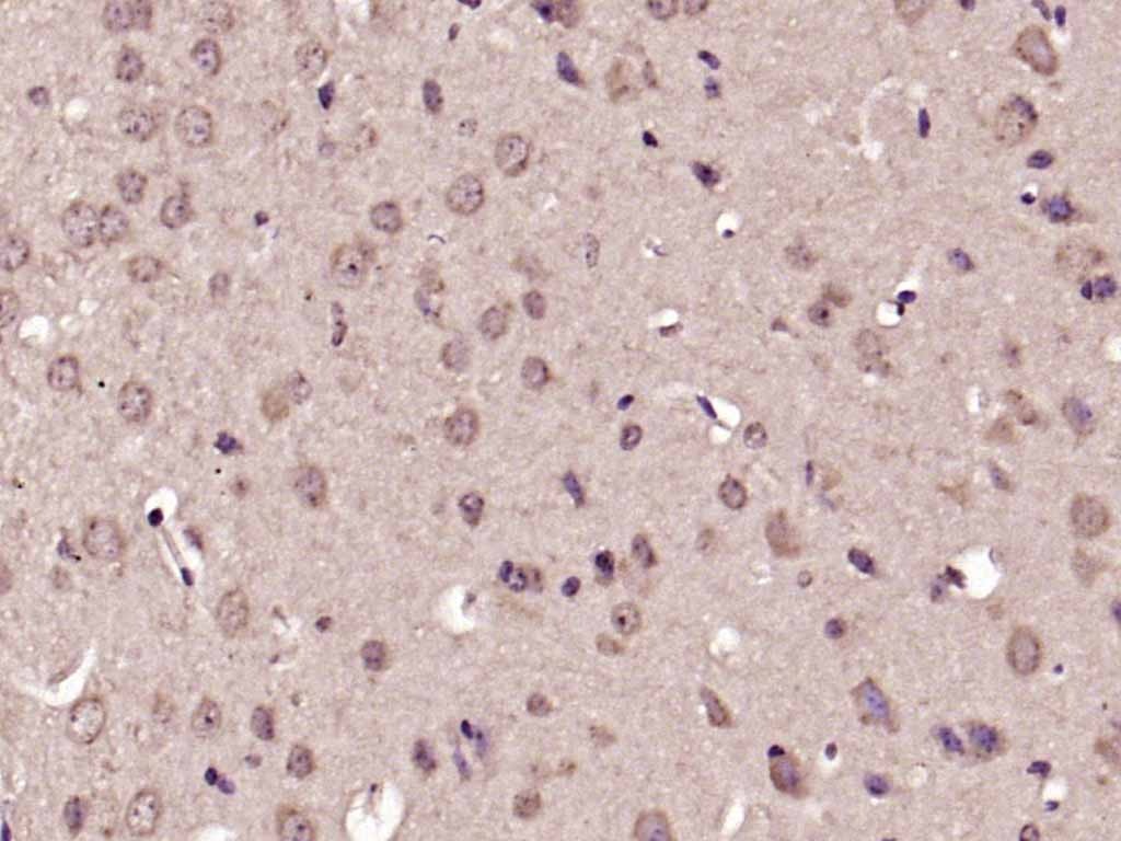 Anti-Phospho-p38 MAPK (Thr180, Tyr182) Polyclonal Antibody 2