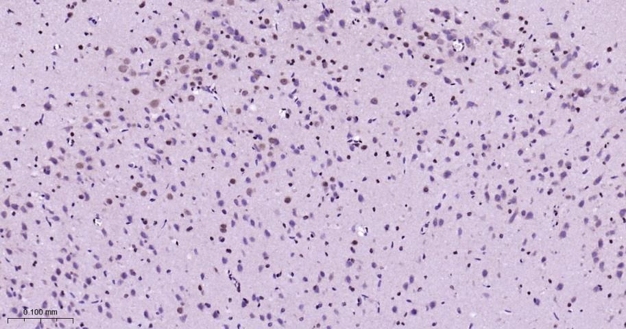 Anti-Phospho-p38 MAPK (Thr180, Tyr182) Polyclonal Antibody