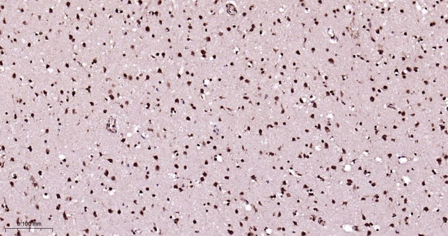 Anti-Phospho-p38 MAPK (Thr180, Tyr182) Polyclonal Antibody