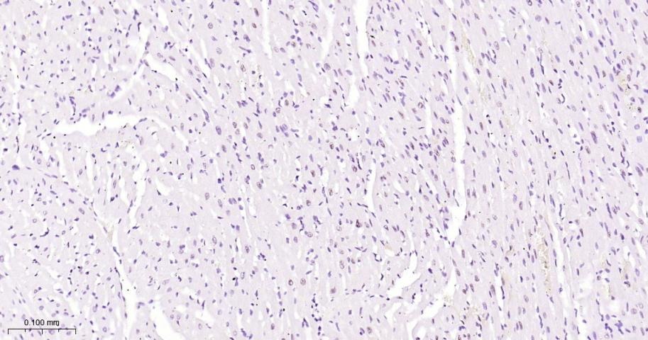 Anti-Phospho-STAT3 (Tyr705) Antibody (2J657)