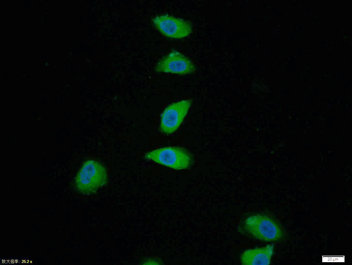 Anti-Phospho-p38 MAPK (Thr180, Tyr182) Polyclonal Antibody 2