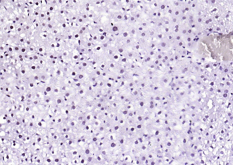Anti-Phospho-STAT1 (Ser727) Antibody (4T516)