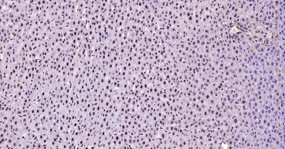 Anti-Phospho-STAT3 (Ser727) Antibody (8J881)