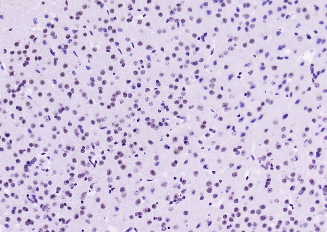 Anti-Phospho-STAT1 (Ser727) Antibody (4T516)