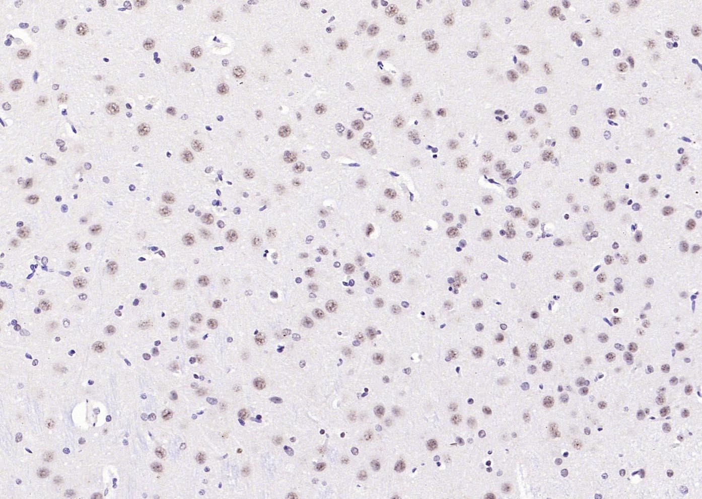 Anti-Phospho-PI3 Kinase p110 beta (Ser1070) Polyclonal Antibody
