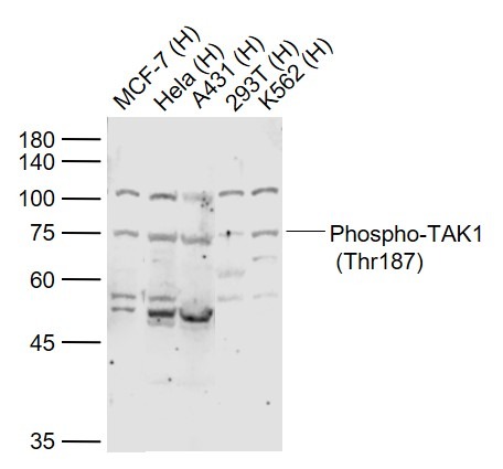 Anti-Phospho-TAK1 (Thr187) Polyclonal Antibody