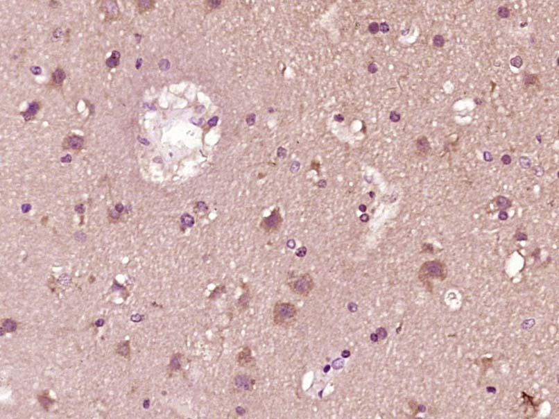 Anti-Phospho-IRF7 (Ser471, 472) Polyclonal Antibody