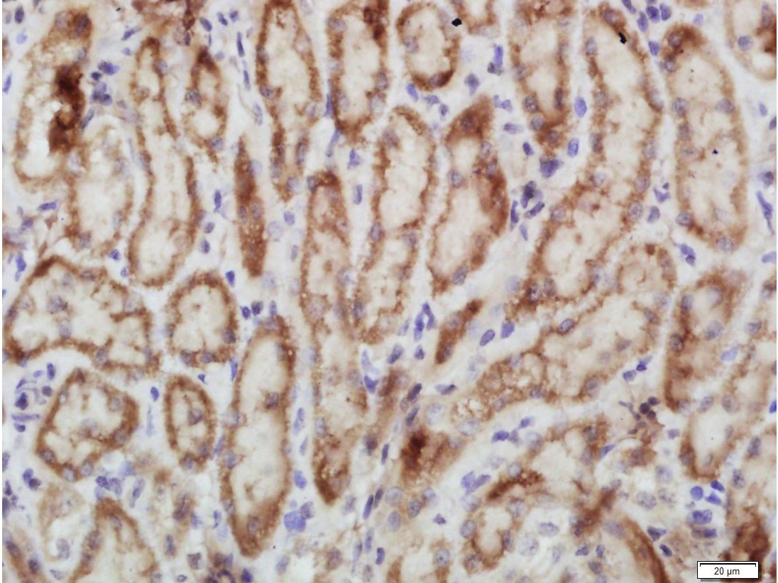 Anti-Phospho-PERK (Thr980) Polyclonal Antibody 2