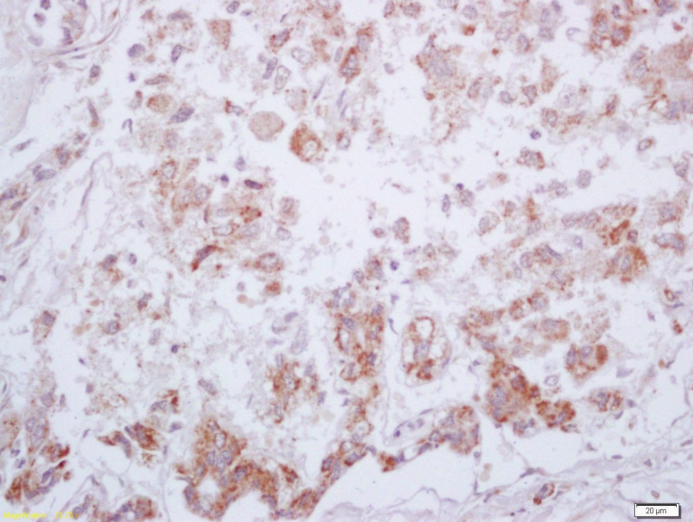 Anti-Phospho-PKM2 (Tyr105) Polyclonal Antibody