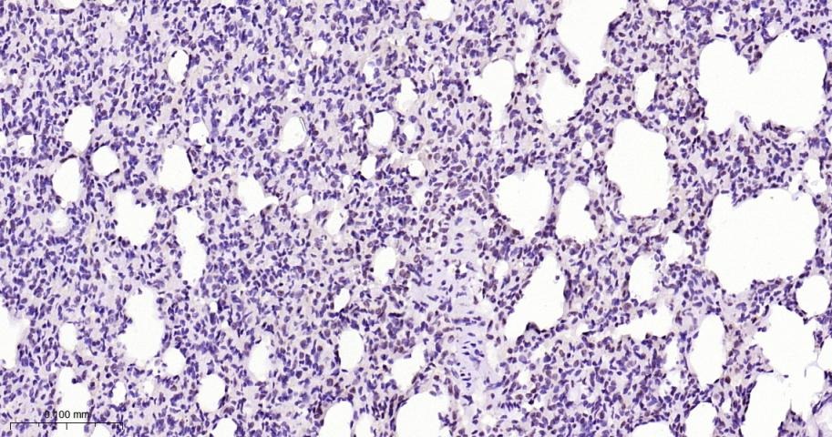 Anti-Phospho-STAT3 (Tyr705) Polyclonal Antibody 2