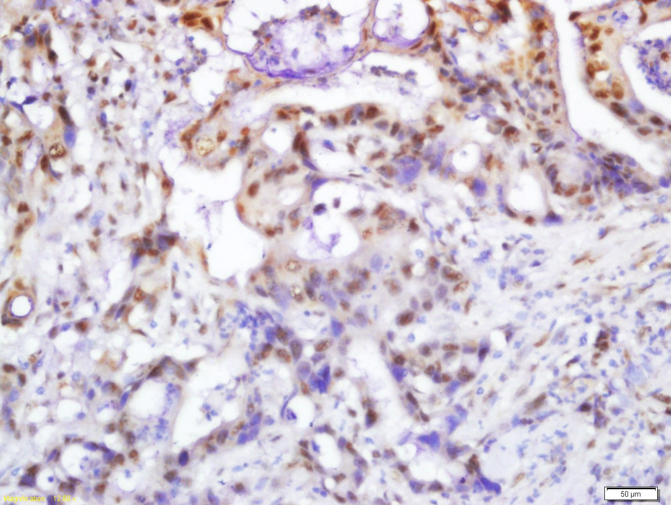 Anti-Phospho-PI3 Kinase p110 beta (Ser1070) Polyclonal Antibody