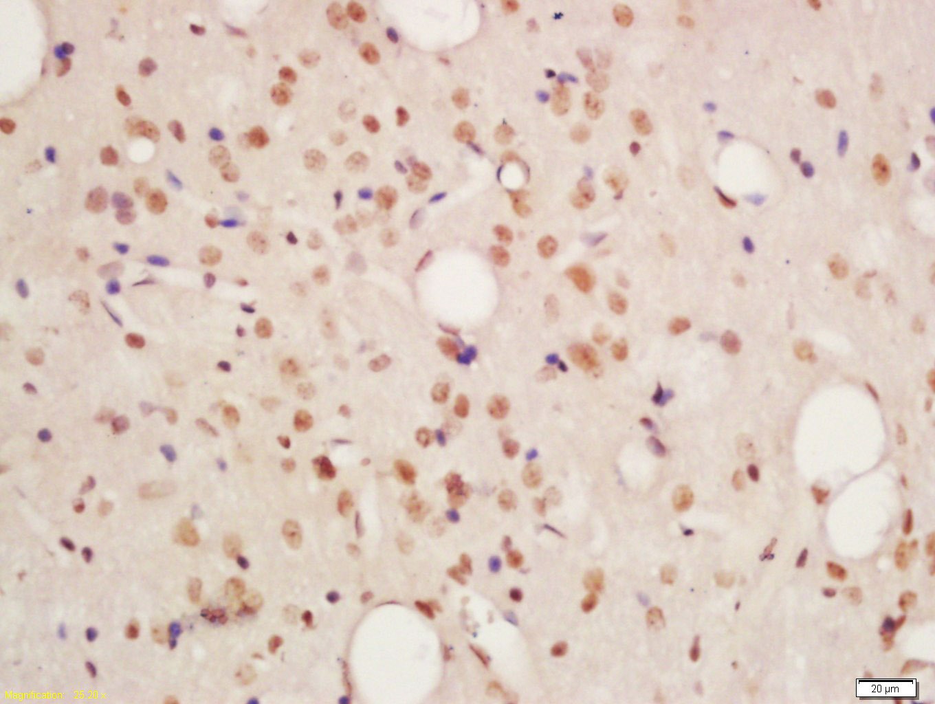 Anti-Phospho-PKM2 (Tyr105) Polyclonal Antibody