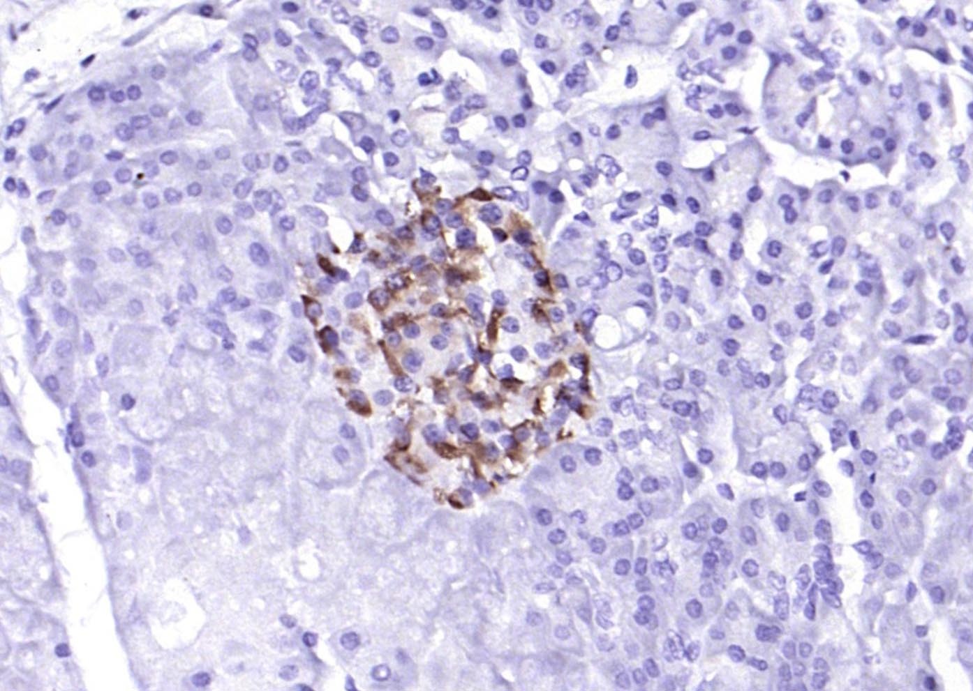 Anti-Phospho-PERK (Thr980) Polyclonal Antibody 2