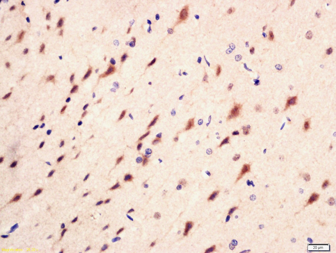 Anti-Phospho-PI3 kinase p85 alpha/gamma (Tyr467, Tyr199) Polyclonal Antibody