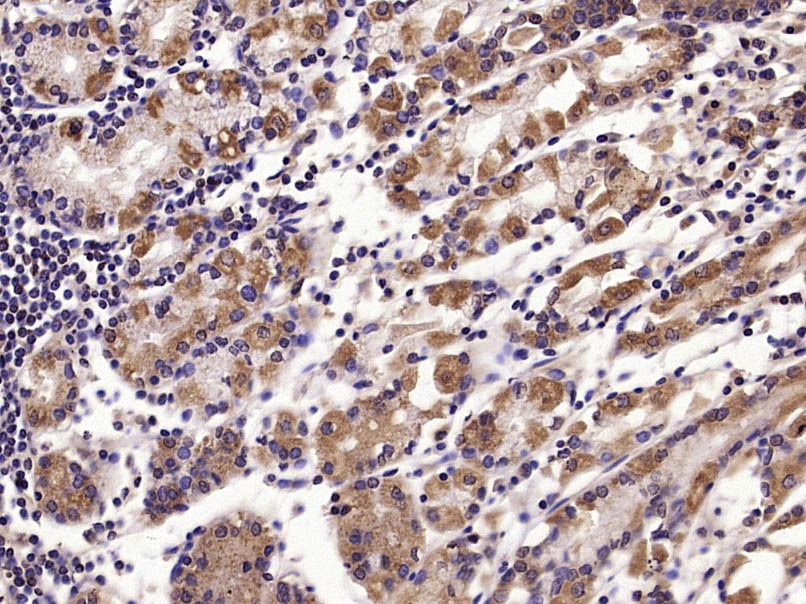 Anti-Phospho-TAK1 (Thr187) Polyclonal Antibody