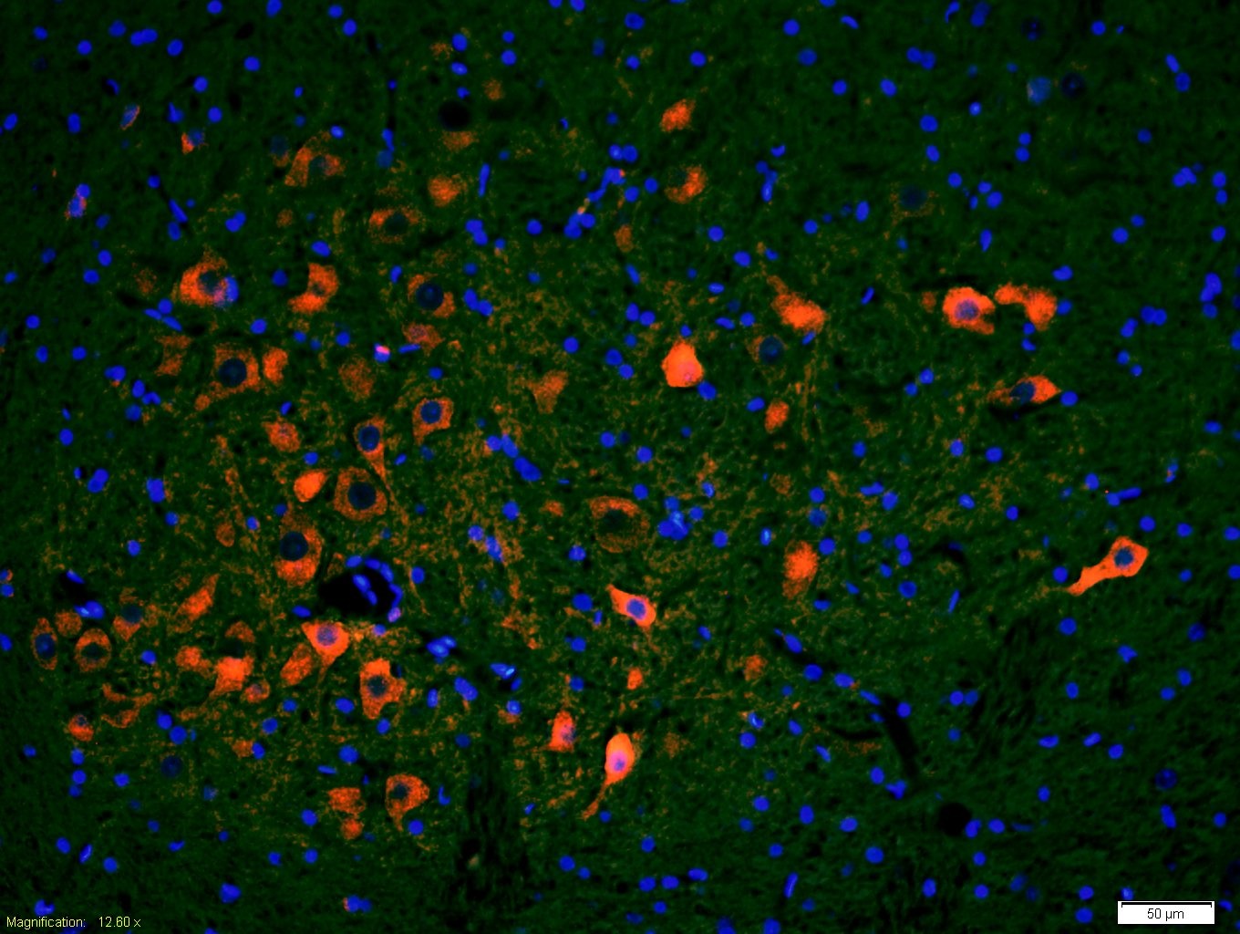 Anti-Phospho-IRF3 (Ser396) Polyclonal Antibody