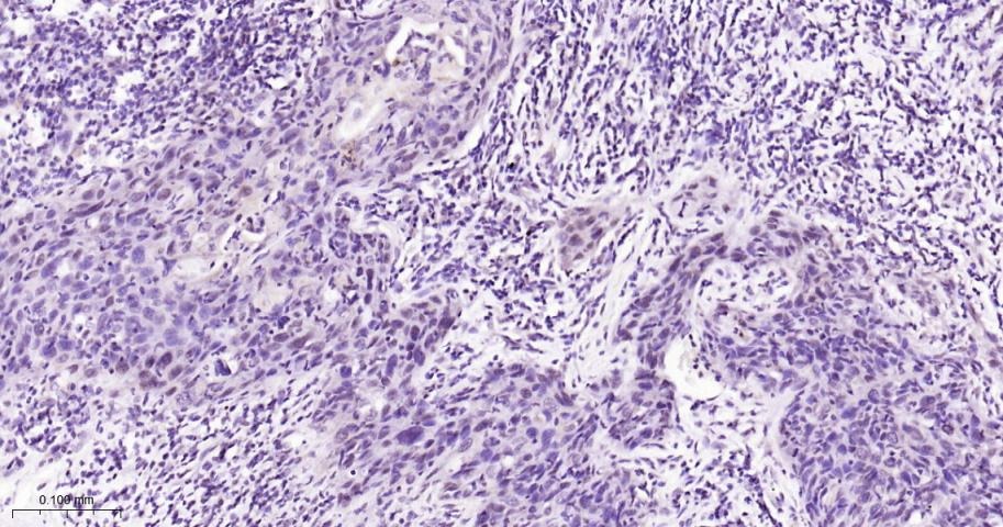 Anti-Phospho-STAT3 (Tyr705) Polyclonal Antibody 2
