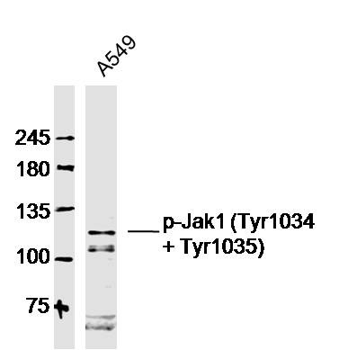 Anti-Phospho-JAK1 (Tyr1034, 1035) Polyclonal Antibody