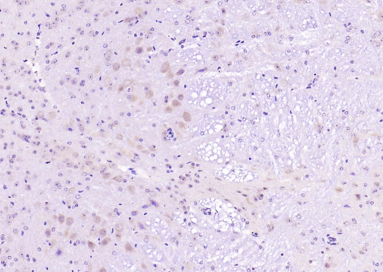 Anti-Phospho-PIK3CA (Tyr317) Polyclonal Antibody