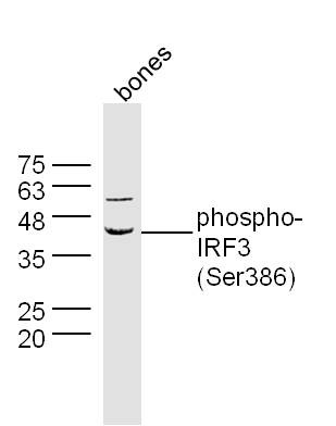 Anti-Phospho-IRF3 (Ser386) Polyclonal Antibody
