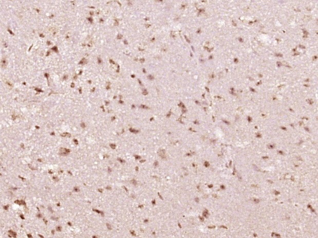 Anti-Phospho-STAT6 (Tyr641) Polyclonal Antibody