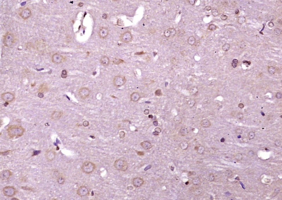 Anti-Phospho-IRE1 (Ser726) Polyclonal Antibody