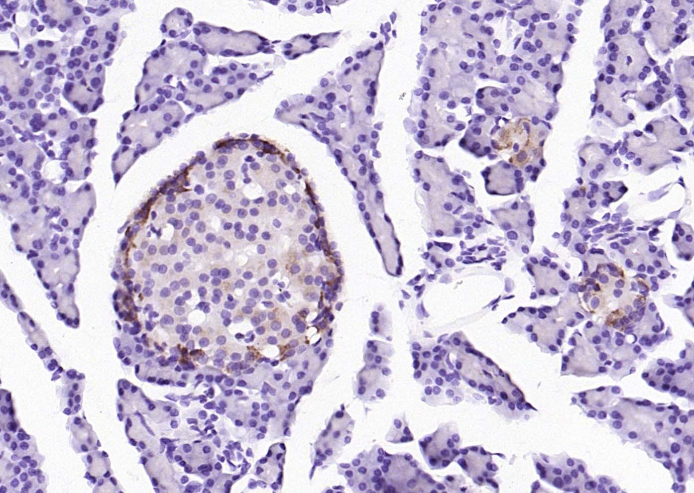 Anti-Phospho-PERK (Thr980) Polyclonal Antibody 2