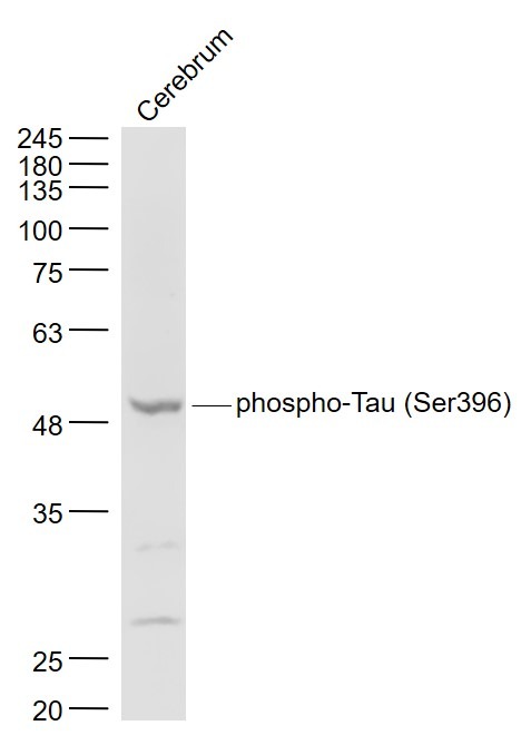 Anti-Phospho-Tau (Ser396) Polyclonal Antibody