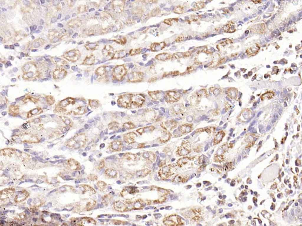 Anti-Phospho-TAK1 (Thr187) Polyclonal Antibody