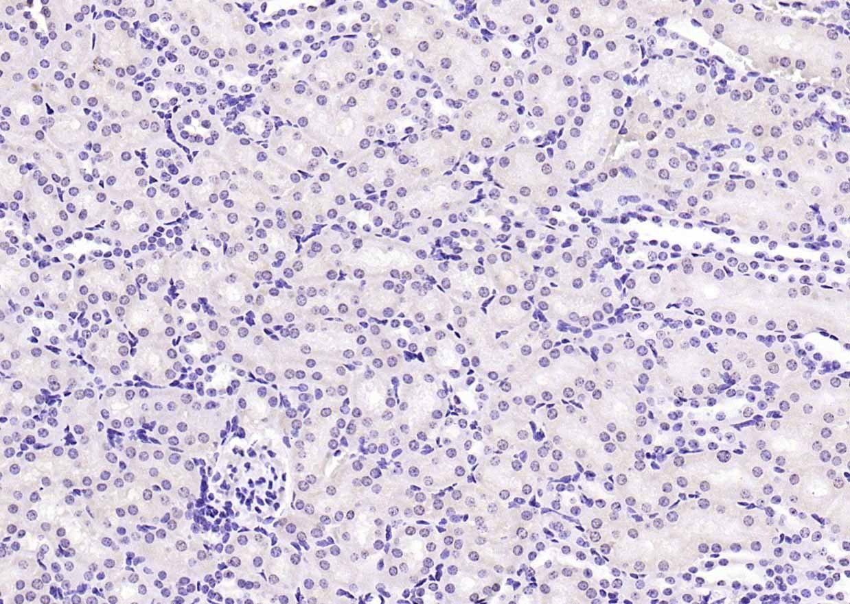 Anti-Phospho-PI3 Kinase p110 beta (Ser1070) Polyclonal Antibody