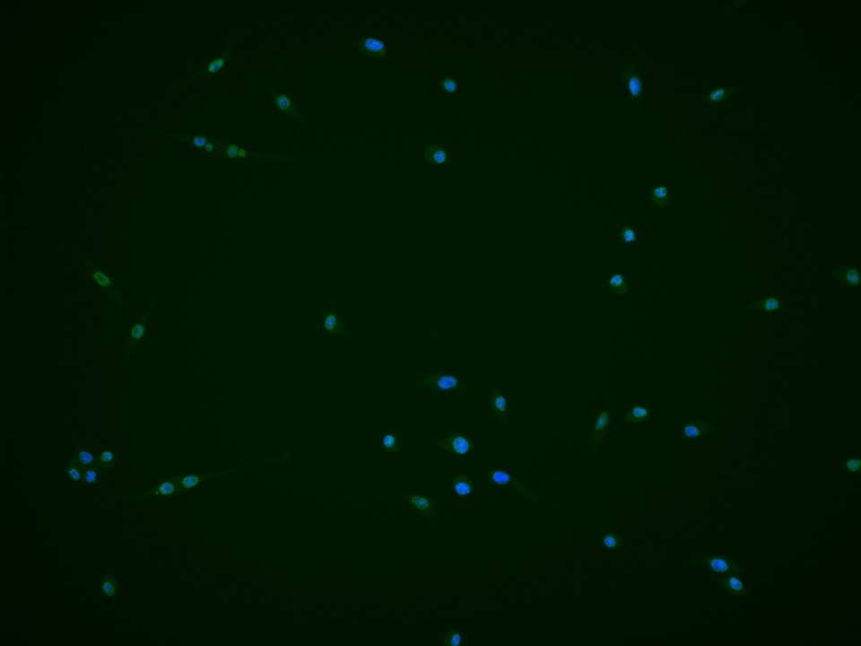 Anti-Phospho-PI3 Kinase p110 beta (Ser1070) Polyclonal Antibody