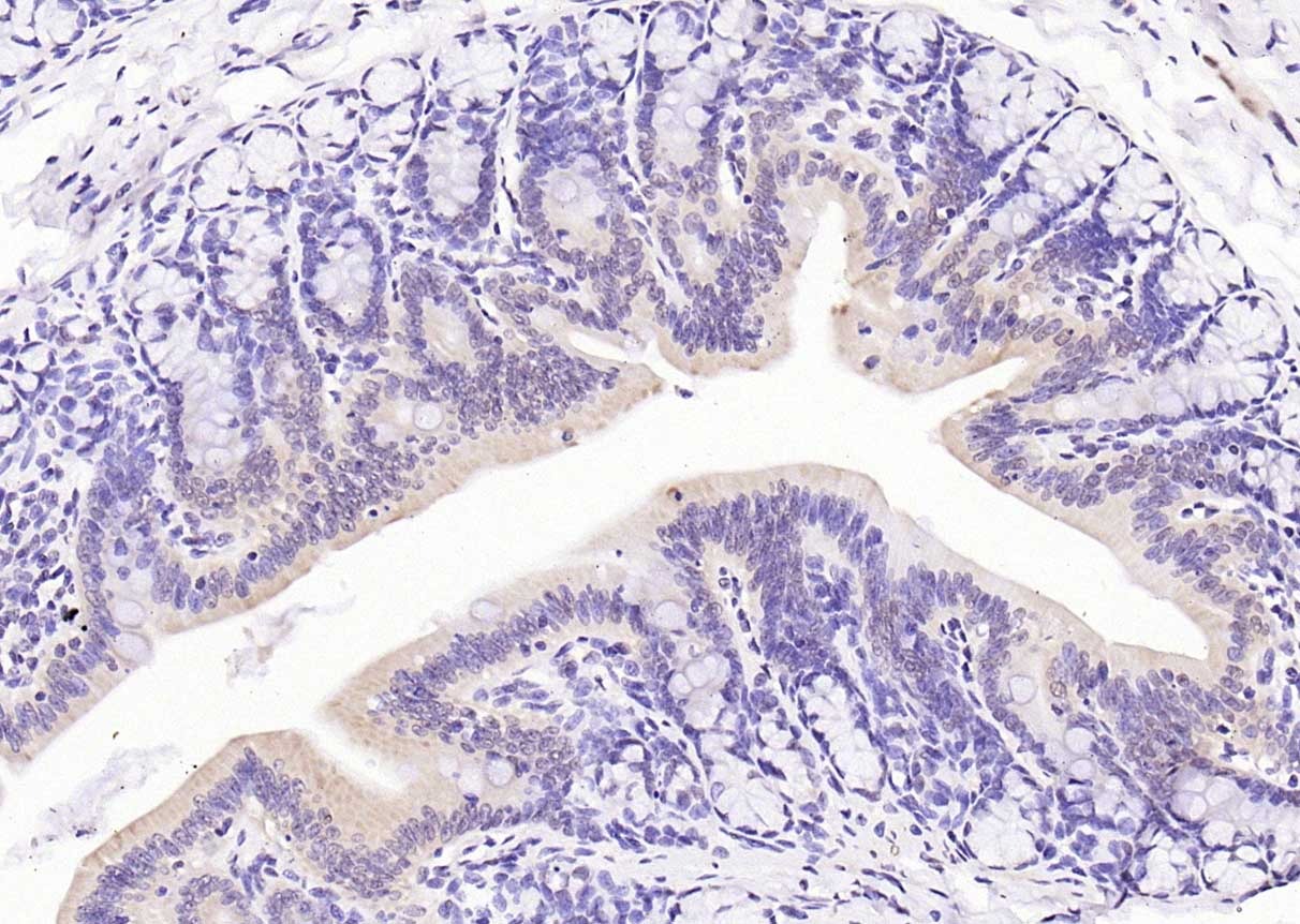 Anti-Phospho-PI3 Kinase p110 beta (Ser1070) Polyclonal Antibody