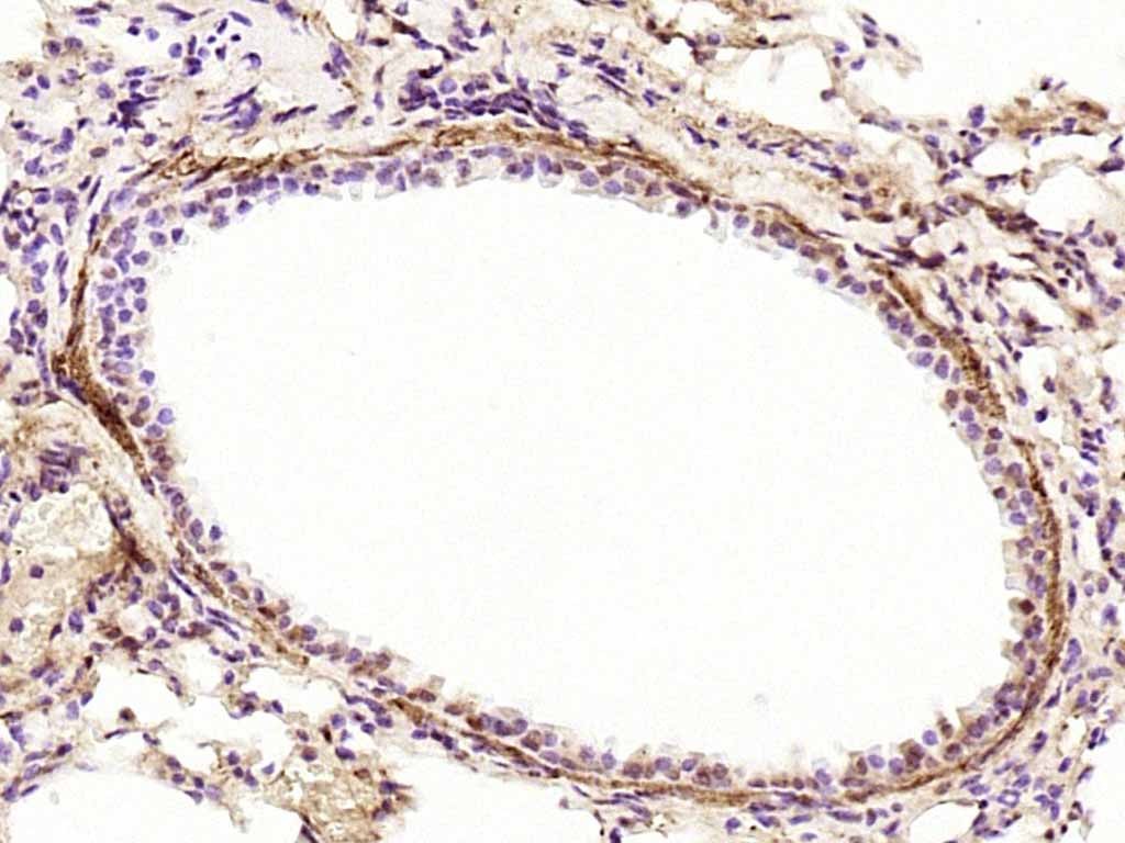 Anti-Phospho-JAK2 (Tyr1007, 1008) Polyclonal Antibody