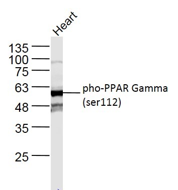 Anti-Phospho-PPAR gamma/PPARG (Ser112) Polyclonal Antibody