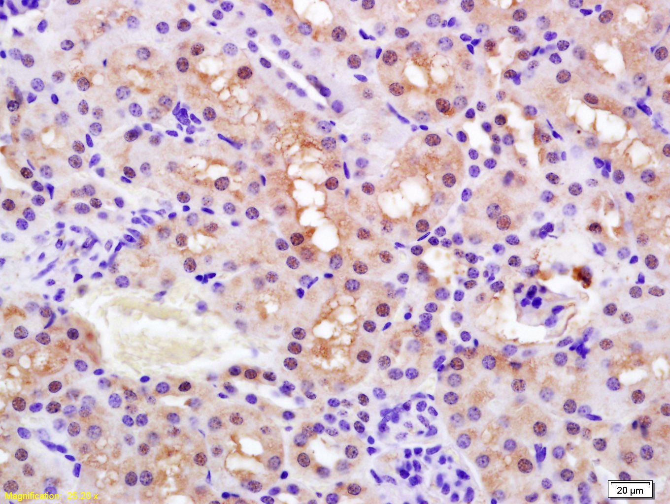 Anti-Phospho-PPAR alpha/PPARA alpha (Ser12) Polyclonal Antibody