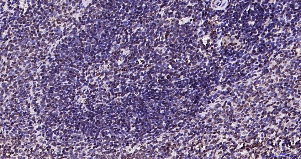 Anti-Phospho-JAK2 (Tyr1007, 1008) Antibody (2X102)